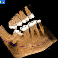 cbct img