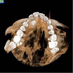 cbct img